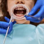 Paura diga dentale 