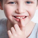 Quali sono i denti da latte