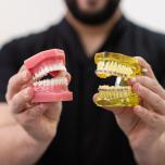 Raddrizzare i denti costo
