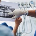 Radiografia denti carie 