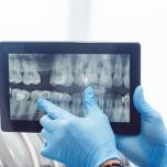 Radiografia endorale