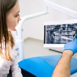 Radiografia mandibola