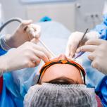 Reazioni dopo estrazione dente
