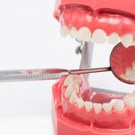 Ricostruzione dentale composito quanto dura