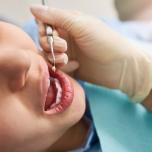Rimozione amalgama dentale effetti collaterali