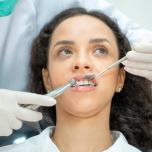 Sensazione dente allungato