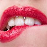 Smiley piercing rovina i denti