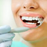 Stripping dentale costo