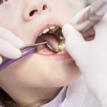 Trapano dentista
