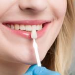 Zirconia dentale