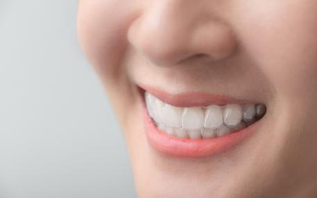 28 denti invece di 32