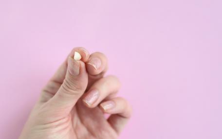 Caduta denti da latte precoce
