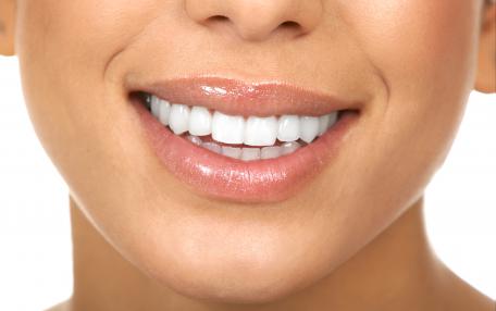 Denti che si muovono leggermente