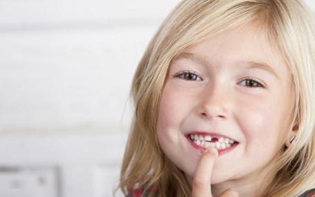 Denti da latte che non cadono nei bambini