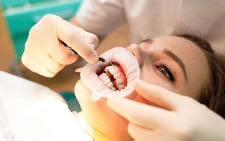 Divaricatore bocca - Come si usa e a cosa serve al dentista