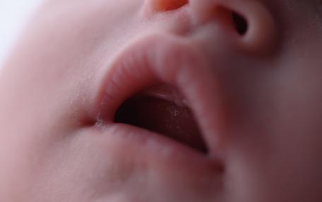Gengive neonato 4 mesi