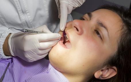 Kit otturazione denti
