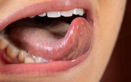 Saliva