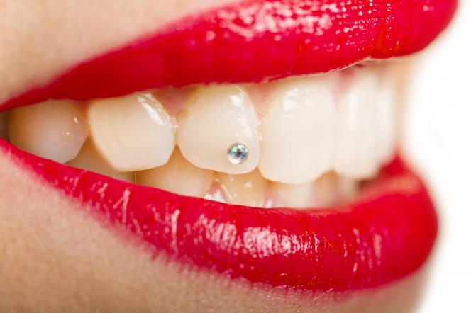 Brillantino al dente Brillantino al dente