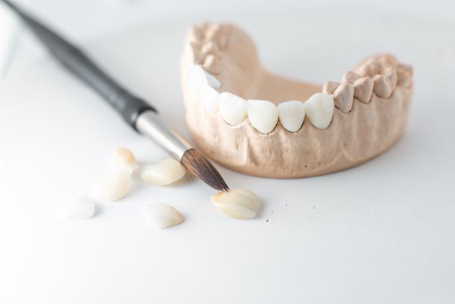Dente ricostruito Dente ricostruito