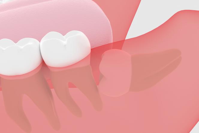 I denti del giudizio crescono a tutti I denti del giudizio crescono a tutti