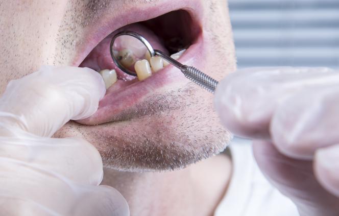 Senza denti a 40 anni Senza denti a 40 anni