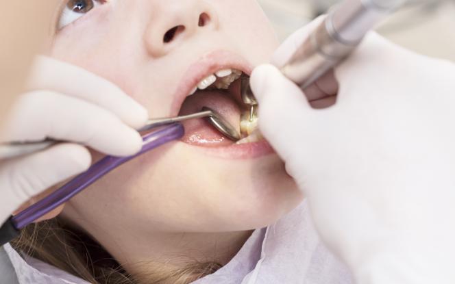 Trapano dentista Trapano dentista