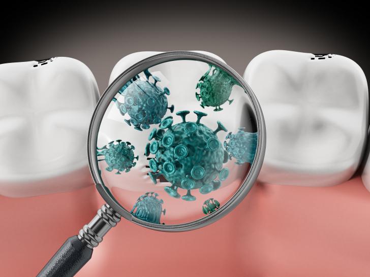 Alitosi per dente del giudizio Alitosi per dente del giudizio