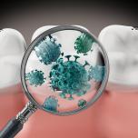 Alitosi per dente del giudizio