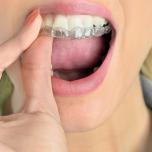 Digrignare i denti da sveglio