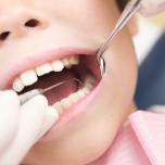 Alveolite secca