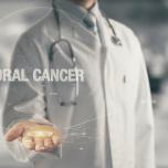 Carcinoma squamocellulare orale