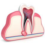 Cisti dentale immagini 