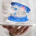 Dente rotto senza dolore