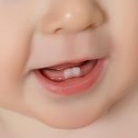 Febbre da dentini quanto alta