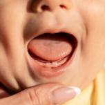 Febbre da dentizione forum