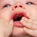 Gengive bianche neonato