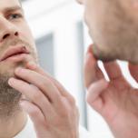 Herpes labiale cause