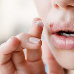Herpes labiale quando preoccuparsi