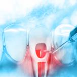 Infezione ai denti cosa provoca