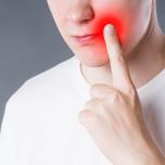 Infiammazione bocca rimedi naturali