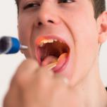 Infiammazione della mucosa orale