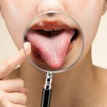 Lingua bianca medicina cinese