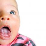 Lingua bianca neonato