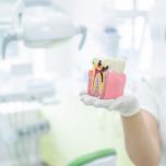 Nervo dente scoperto