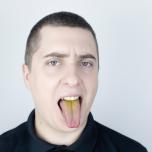 Palato giallo