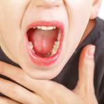 Palato gonfio vicino ai denti