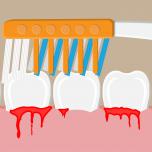 Sanguinamento gengive quando lavo i denti