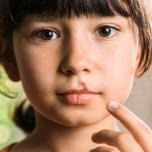 Stomatite erpetica bambini