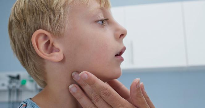 Mal di denti linfonodi ingrossati